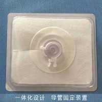 体表导管固定装置